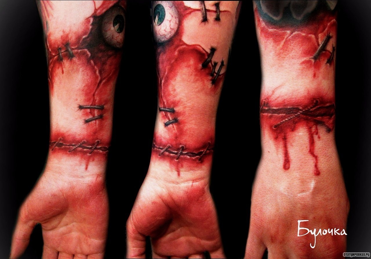 Фотография татуировки под названием «Зашитая кожа на руке с глазом»