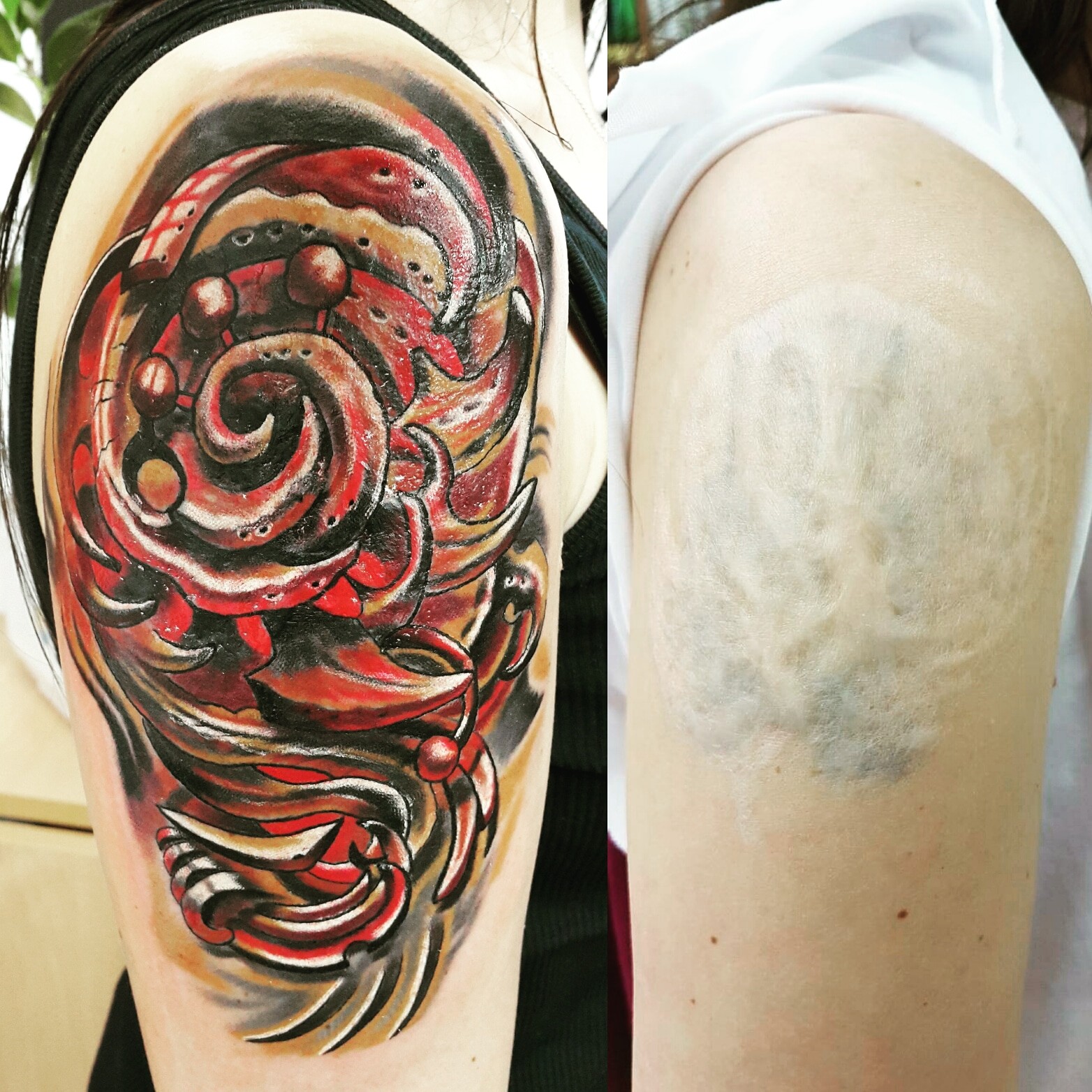 Фотография татуировки под названием «Биоорганика (перекрытие шрамов)»